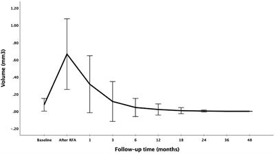 The Efficacy and Safety of Radiofrequency Ablation for Bilateral Papillary Thyroid Microcarcinoma